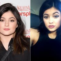 Kylie Jenner, prea devreme pentru interventii estetice?